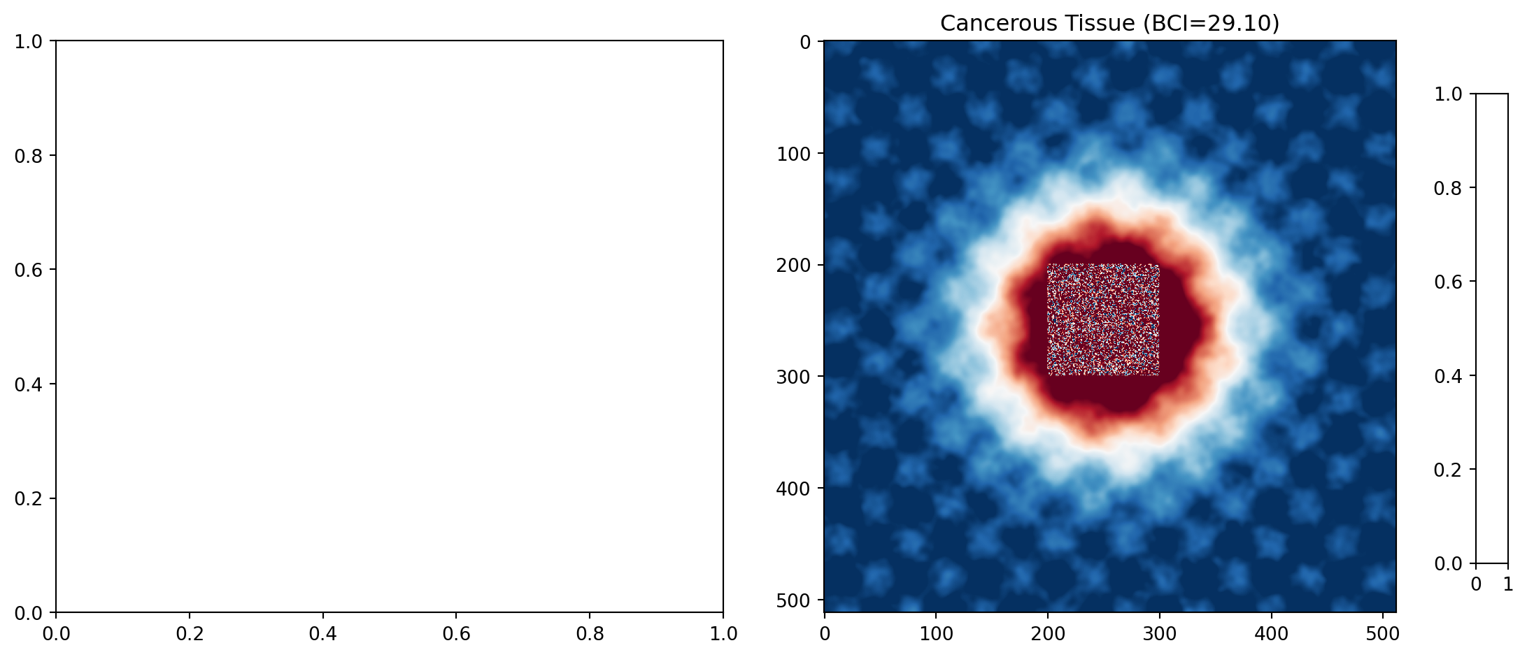 Bioelectric Pattern Corruption in Cancer